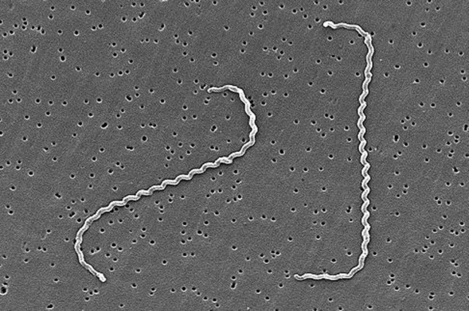 
 Bakteri leptospirosis, Foto : Wikipedia
